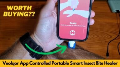 Veolqor Smart Insect Bite Healer App Controlled Heat Itch Relief Portable Unboxing & Review
